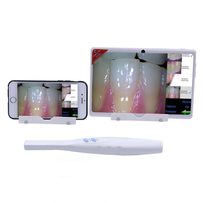 CF-682 Dental Super Cam Cordless Intraoral Camera with Wifi