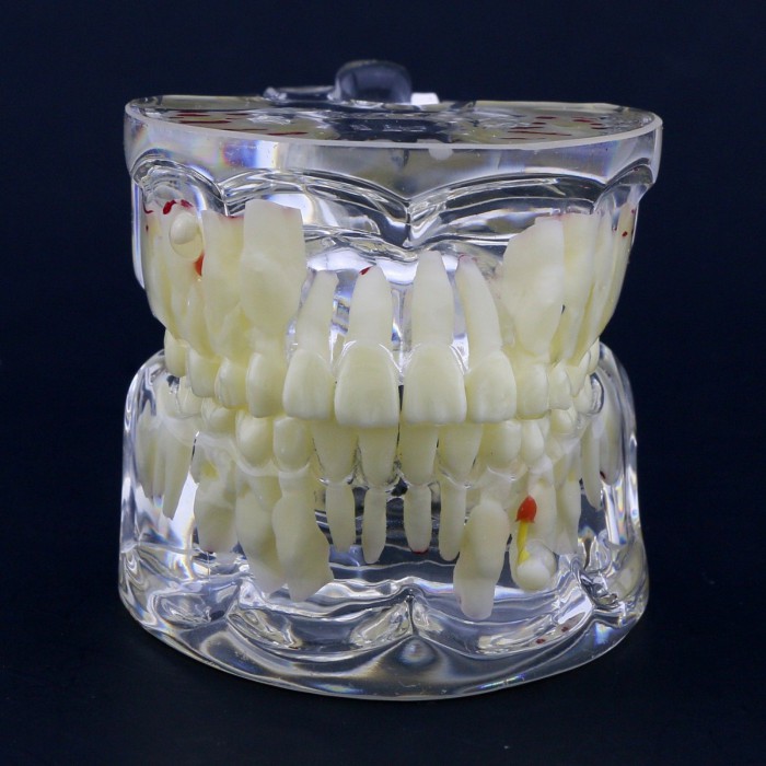 Dental Children Pediatric Pathology Demonstration Education Study Teeth Model 4002
