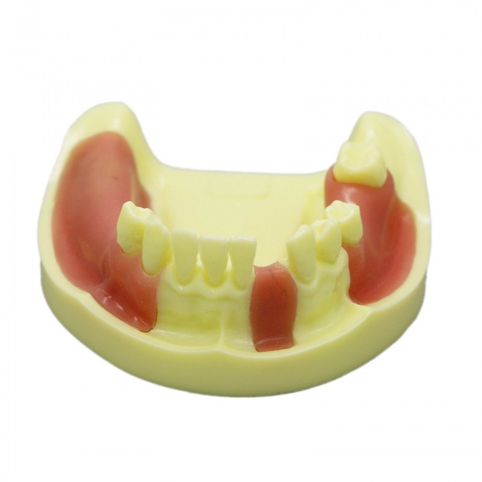 Dental Implant Model Lower Jaw Training Practice Demo Model with Gingiva #2004 01