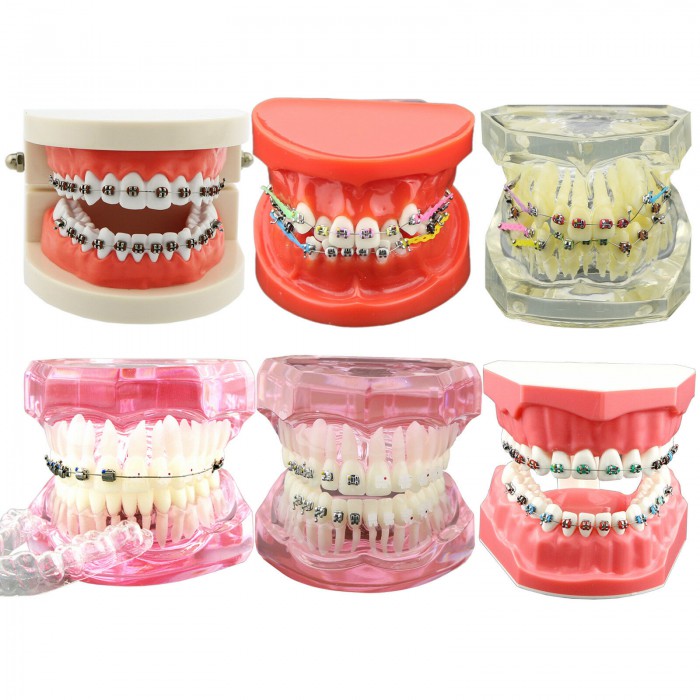 Dental Orthodontic Teeth Model with Metal Ceramic Bracket Tube Self-ligating Chain