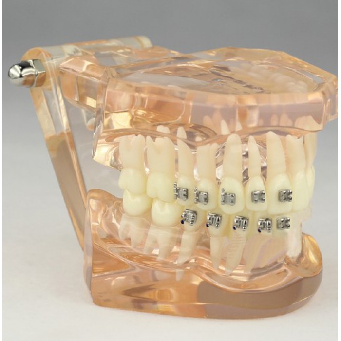 Dental Orthodontic Typodont Study Model with Ceramic Brackets M3009