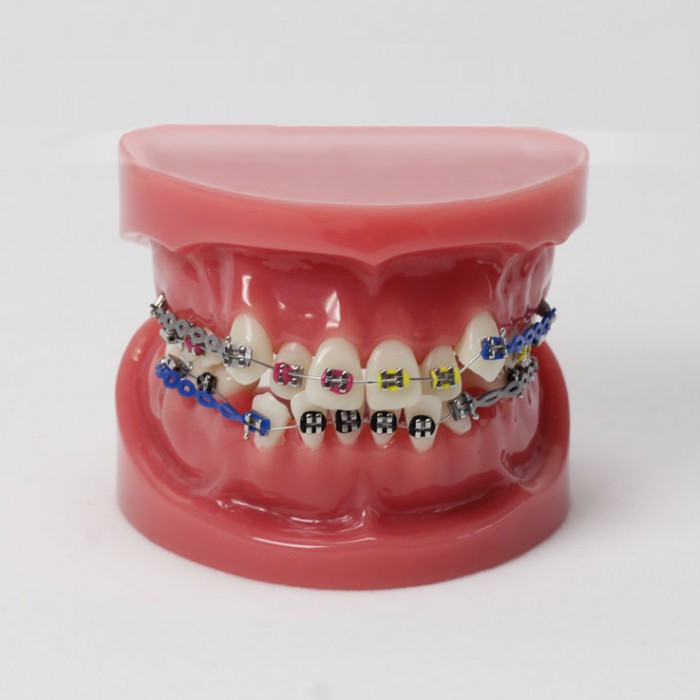 Dental Teeth Demo Model With Bracket Standard Study Education Model M3005