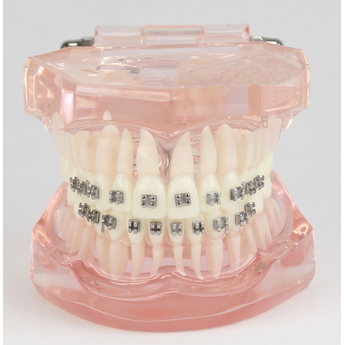 Dental Teeth Demo Model With Metal Bracket for Patient Education M3001