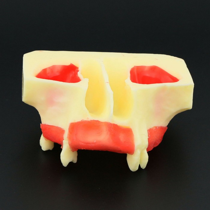 Dental Teeth Model Sinus Lift Practice Training Model Study Teaching Model 2013 01