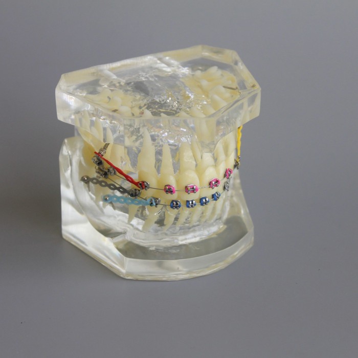 Dental Typodont Model Orthodontic Demonstration Practice Model With Metal Bracket Archwire