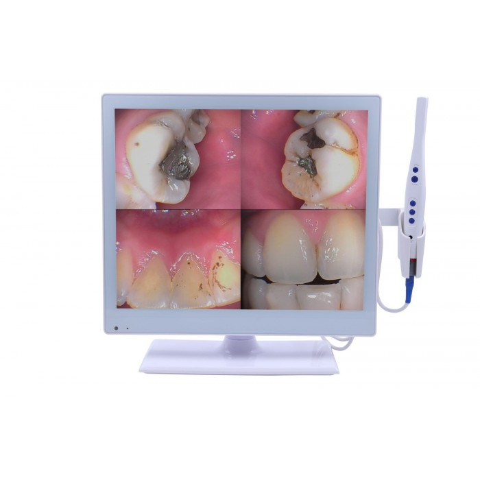 M-978 Dental 2-in-1 Wired Intraoral Camera with 17 Inch LED Monitor HDMI USB VGA