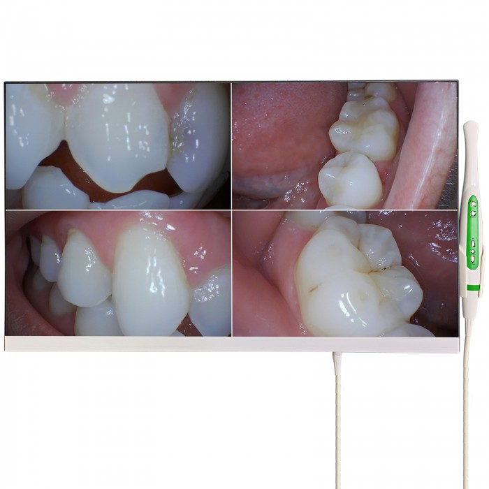 Magenta YF-2400M Dental Intraoral Camera with 24 Inch Monitor and Wifi
