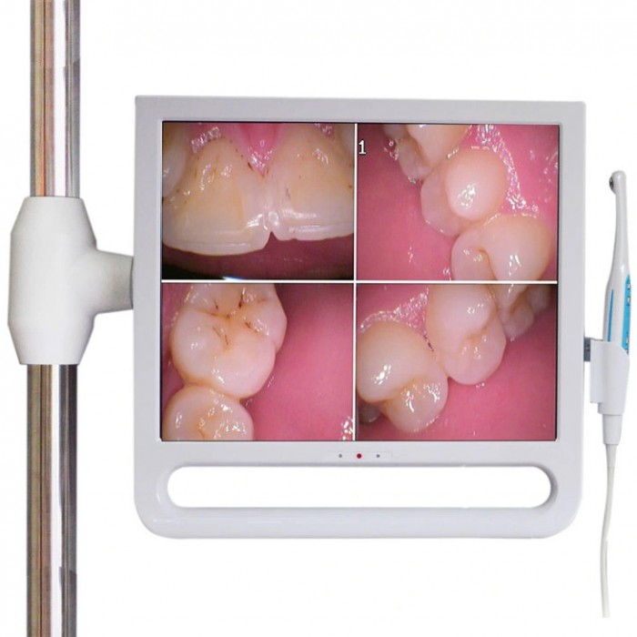 Magenta YF1700M Intraoral Camera with 17 Inch Screen & WIFI