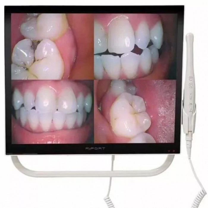 Magenta YFHD-D Intraoral Camera with 17 Inch Monitor & Bracket 1/4 sony CCD