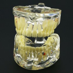 Dental Children Teeth Model Pediatric Demonstration Study Training Education Model 4002