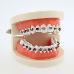 Dental Demonstration Teeth Model with Braces For Patient Education 5006