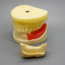 Dental Implant Practice Model with Replaceable Implant Socket 2002