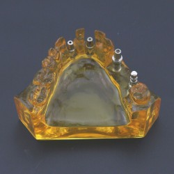Dental Implant Typodont Teeth Model Upper Jaw Demo Model #201102