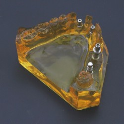 Dental Implant Typodont Teeth Model Upper Jaw Demo Model #201102