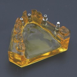Dental Implant Typodont Teeth Model Upper Jaw Demo Model #201102