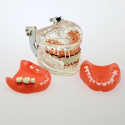 Dental Model Adult Periodontal Disease Study Demo Training Teeth Model 4017
