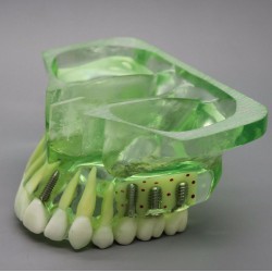 Dental Model Upper Jaw Implant Study Training Demo Model with Sinus 2015 01