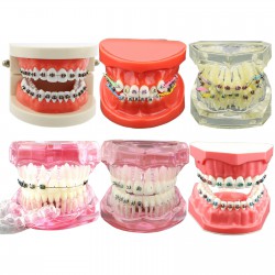 Dental Orthodontic Teeth Model with Metal Ceramic Bracket Tube Self-ligating Chain