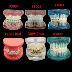 Dental Orthodontic Typodont Model Demonstration Study Training Teeth Model