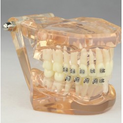 Dental Orthodontic Typodont Study Model with Ceramic Brackets M3009