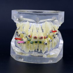 Dental Orthodontic Typodont Study Training Model With Metal Brackets