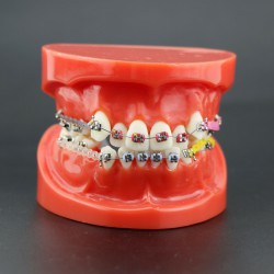 Dental Orthodontics Study Training Typodont Model With Metal Bracket Arch Wire Chain Tie 3005R