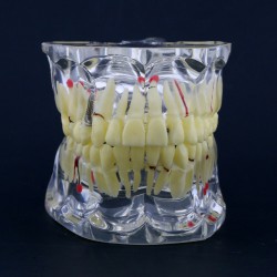 Dental Study Model Adult Pathology Typodont Teeth Teaching Model #4001