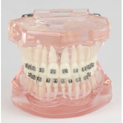 Dental Teeth Demo Model With Metal Bracket for Patient Education M3001