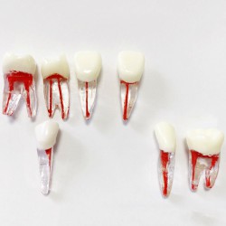 Dental Teeth Practice Model Endo File Molar Upper Lower Tooth Premolar Root 2/3-Rooted Canal