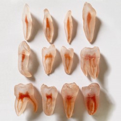 12Pcs Molar Incisor Cuspid Teeth Model Dental Endo Files Path for Endodontic Training Practice
