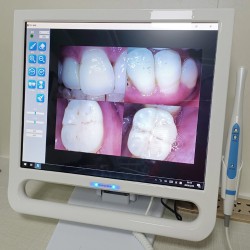 Magenta YF-1700P+ 17 Inch Touch Screen Intraoral Camera