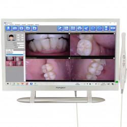 Magenta YF-2200P+ 21.5 Inch Touch Screen Intraoral Camera VGA+HDMI