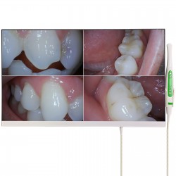 Magenta YF-2400M Dental Intraoral Camera with 24 Inch Monitor and Wifi
