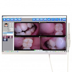 Magenta YF-2400P 24 Inch Touch Screen Intraoral Camera with WIFI
