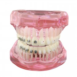 Orthodontic Teeth Model with Metal and Ceramic Bracket Braces Dental Study Training Model 3003