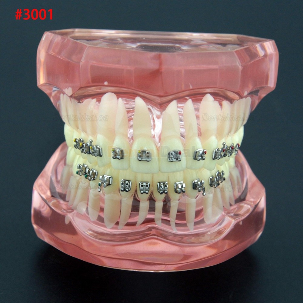 Dental Orthodontic Typodont Model Demonstration Study Training Teeth Model