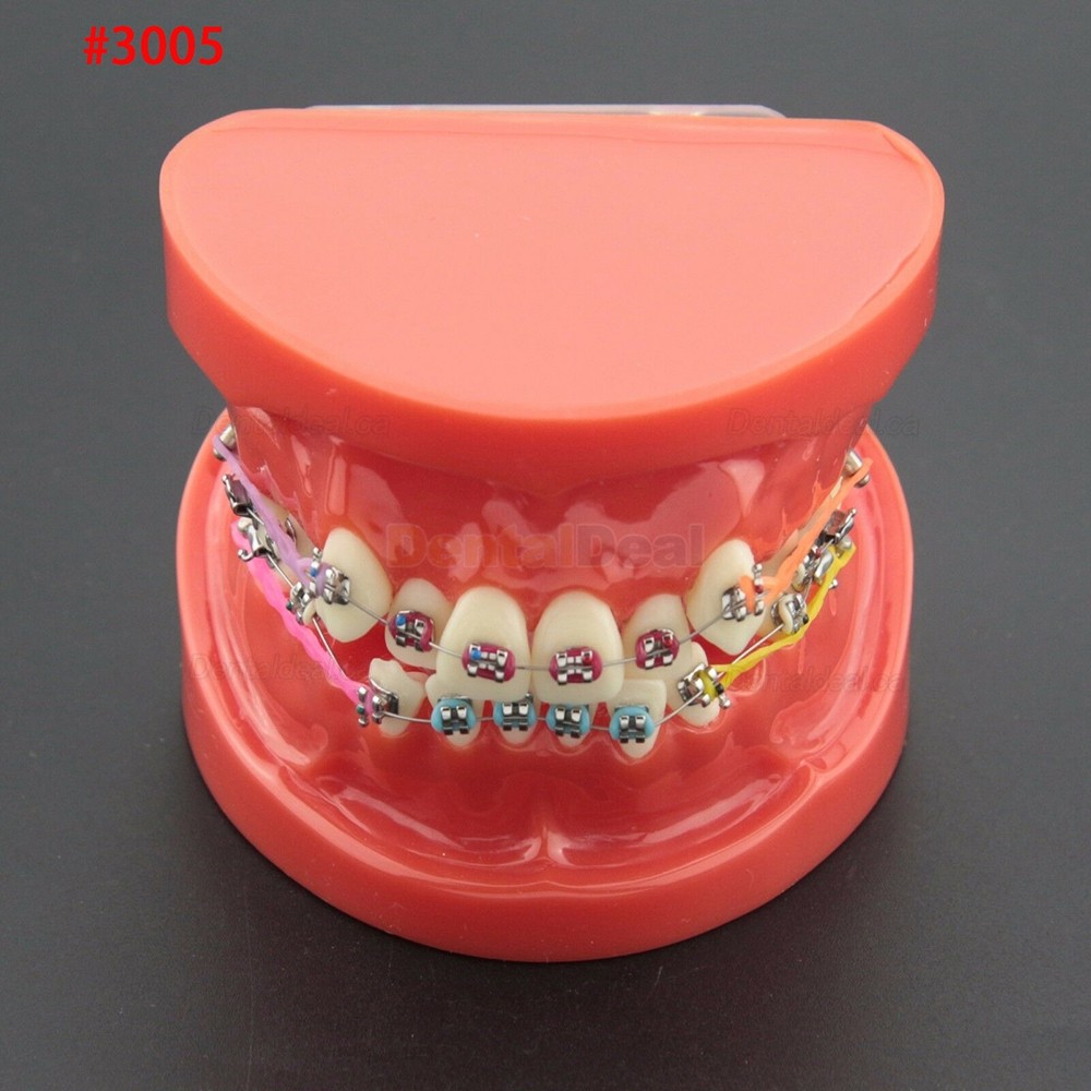 Dental Orthodontic Typodont Model Demonstration Study Training Teeth Model