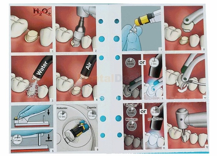 Dental Capsules Activator and Applier Capsules Activator Applier Gun