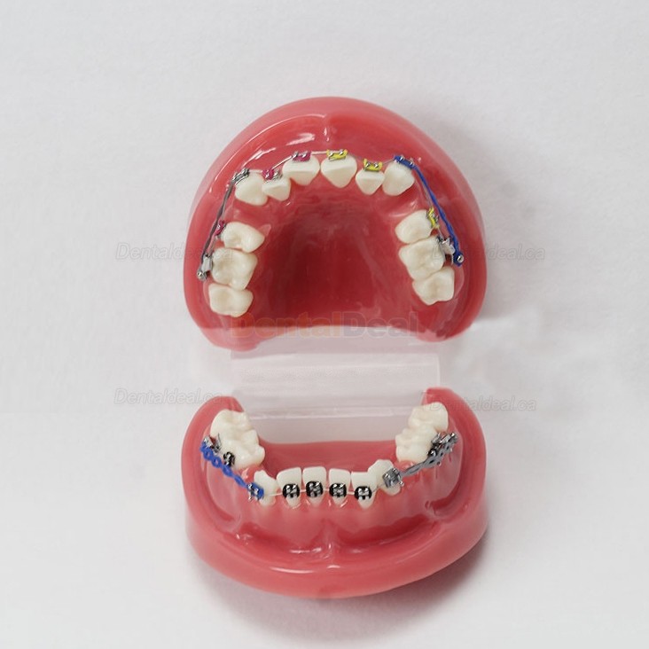 Dental Teeth Demo Model With Bracket Standard Study Education Model M3005