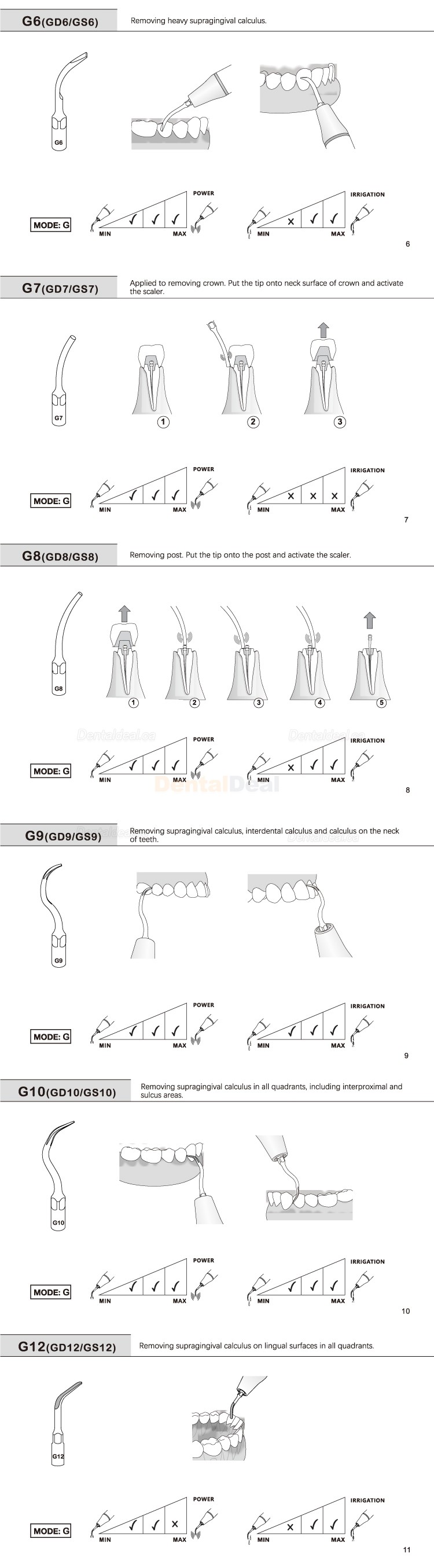 10Pcs Refine&reg; Ultrasonic Piezo Scaling Tips G1 G2 G3 G4 G5 G6 GD1 GD2 GD3 GD4 GD5 GD6 Fit EMS Woodpecker