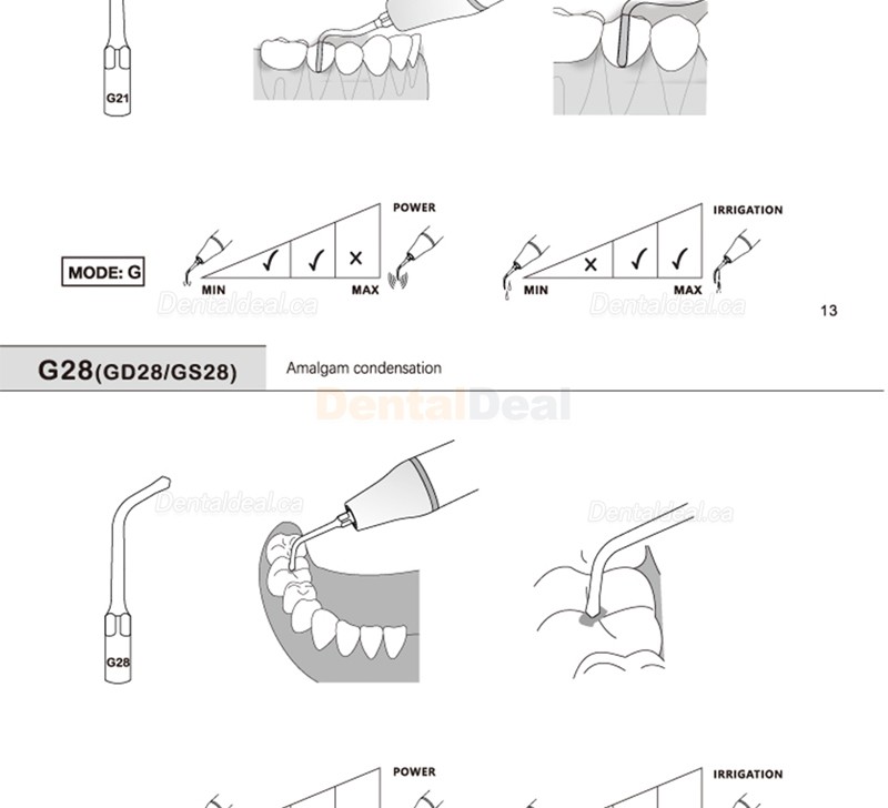 5Pcs Refine&reg; Ultrasonic Piezo Restorative Tips G20 G21 G30 G31 G32 G33 G35 Fit EMS Woodpecker