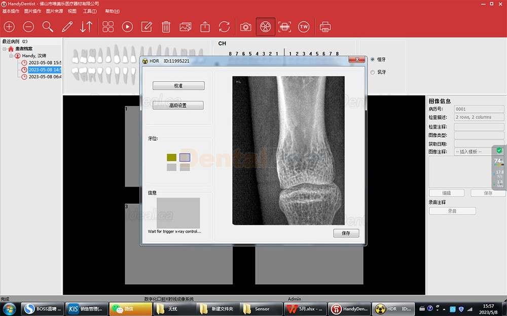 Handy HDR 500B Dental Xray Sensor Digital Intraoral Sensor
