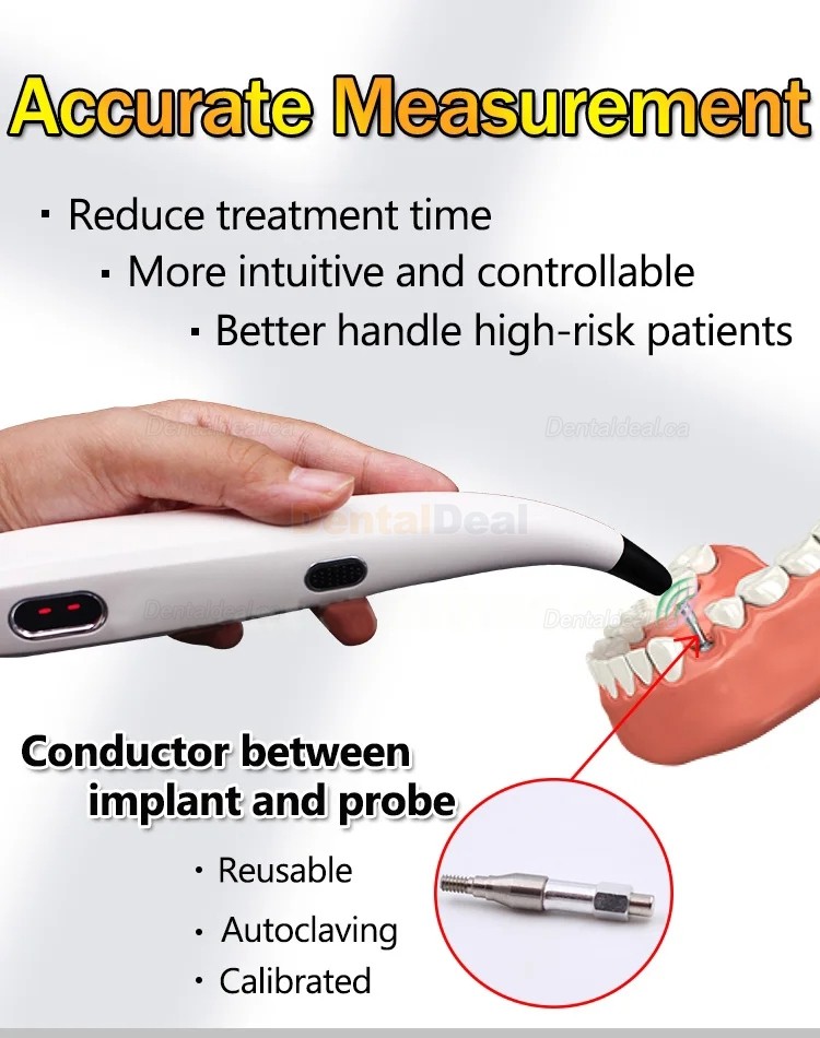 Denta Implant Stability Tester Implant Osseointegration Monitor ISQ Monitor