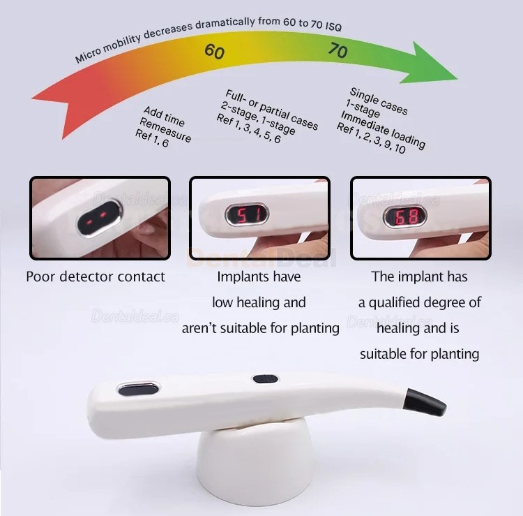 Denta Implant Stability Tester Implant Osseointegration Monitor ISQ Monitor