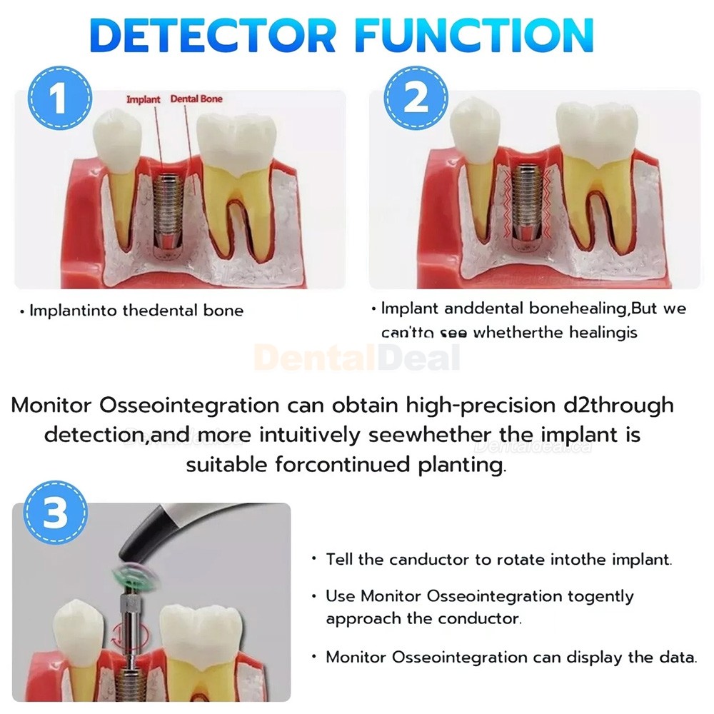 Denta Implant Stability Tester Implant Osseointegration Monitor ISQ Monitor