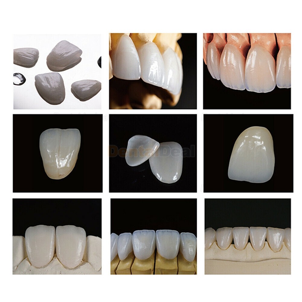 5Pcs B40 HT/LT Dental Lab Lithium Dislicate Glass Ceramic Blocks Fit Sirona Cerec CAD/CAM System