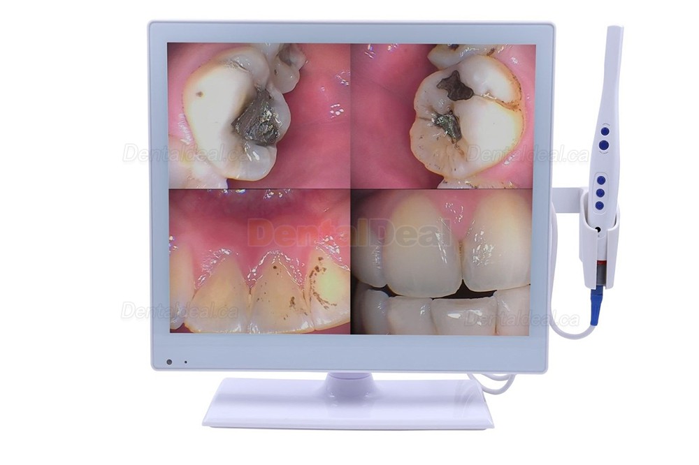 M-978 Dental 2-in-1 Wired Intraoral Camera with 17 Inch LED Monitor HDMI USB VGA