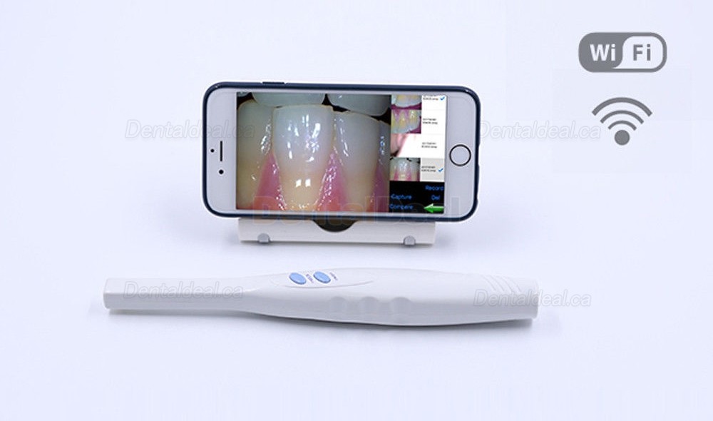 CF-682 Dental Super Cam Cordless Intraoral Camera with Wifi