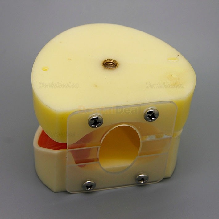 Dental Implant Practice Model with Replaceable Implant Socket 2002