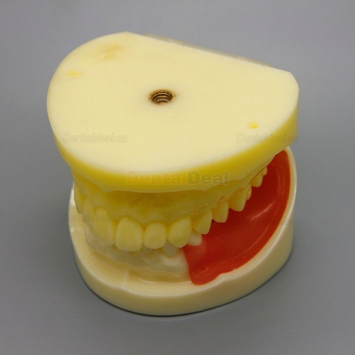 Dental Implant Practice Model with Replaceable Implant Socket 2002